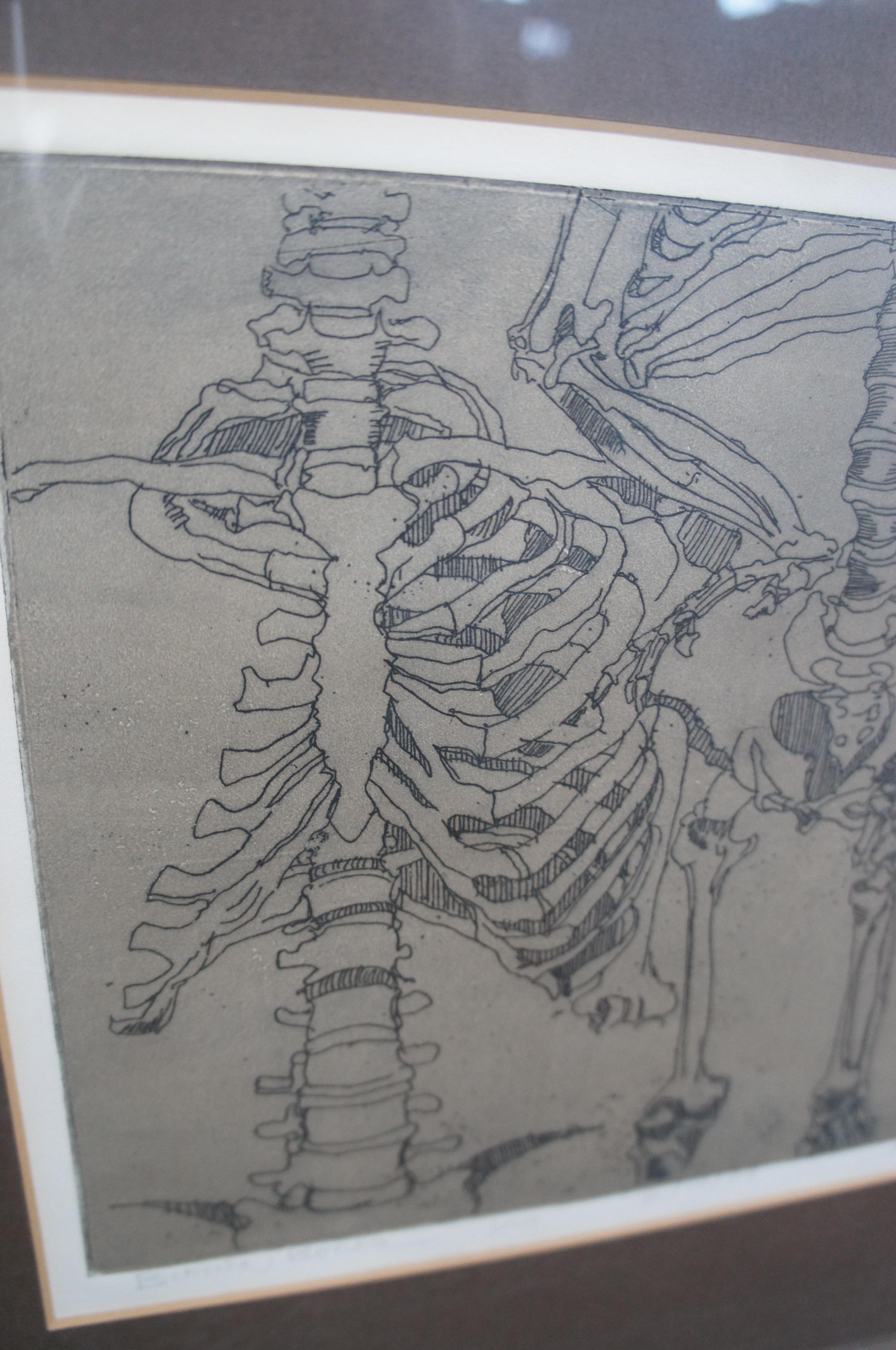 Dean Pingrey Brown Bones Human Anatomy Skeleton Etching 6