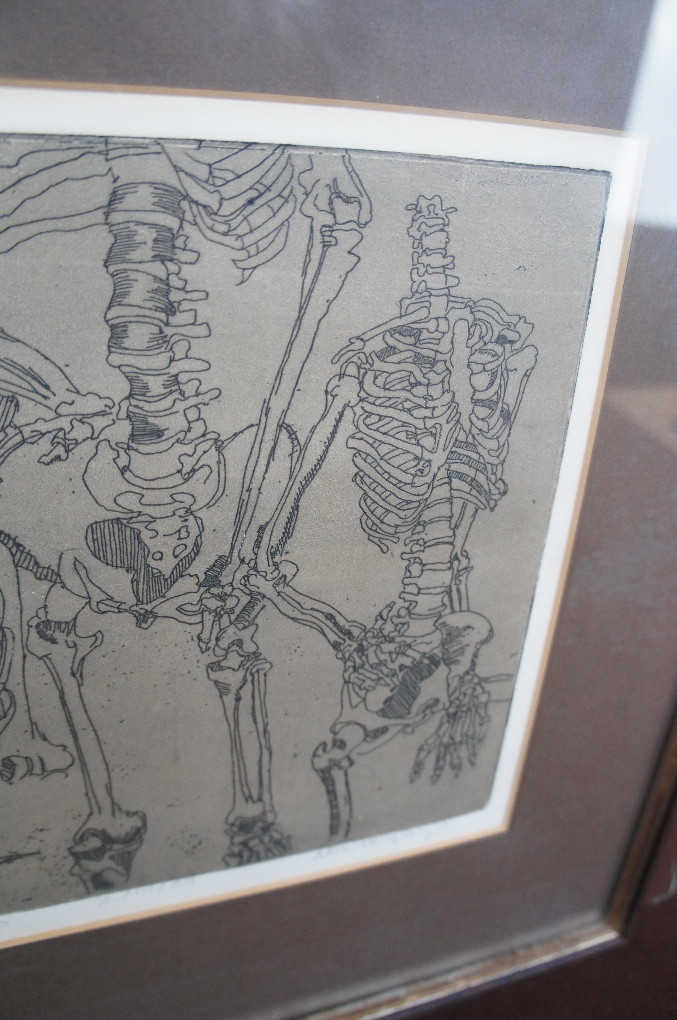 Dean Pingrey Brown Bones Human Anatomy Skeleton Etching 7