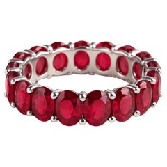 Anillos de banda