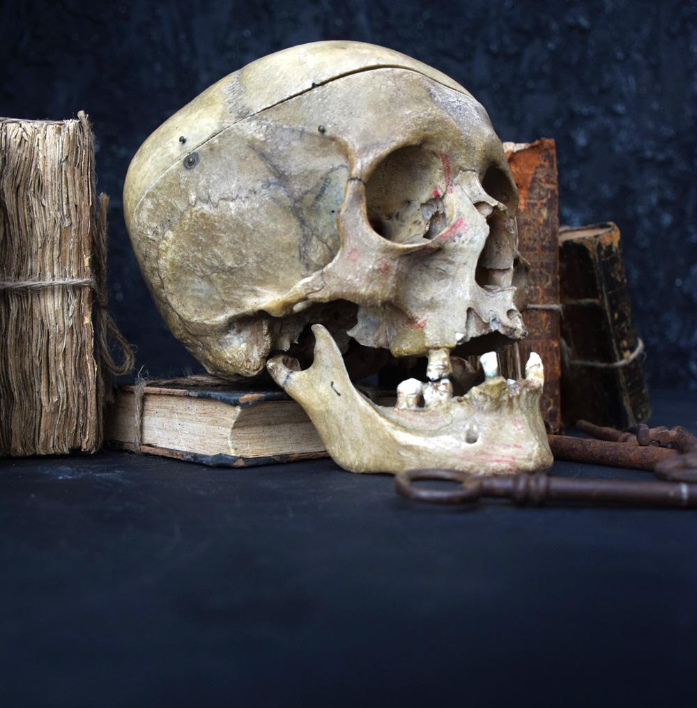 British Deformed Human Skull 0.3