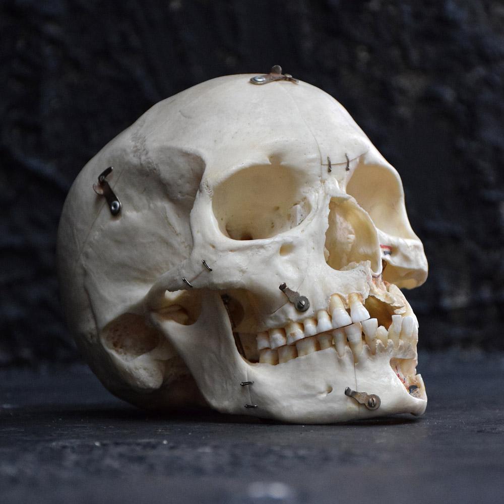 Victorian Demonstration Human Skull