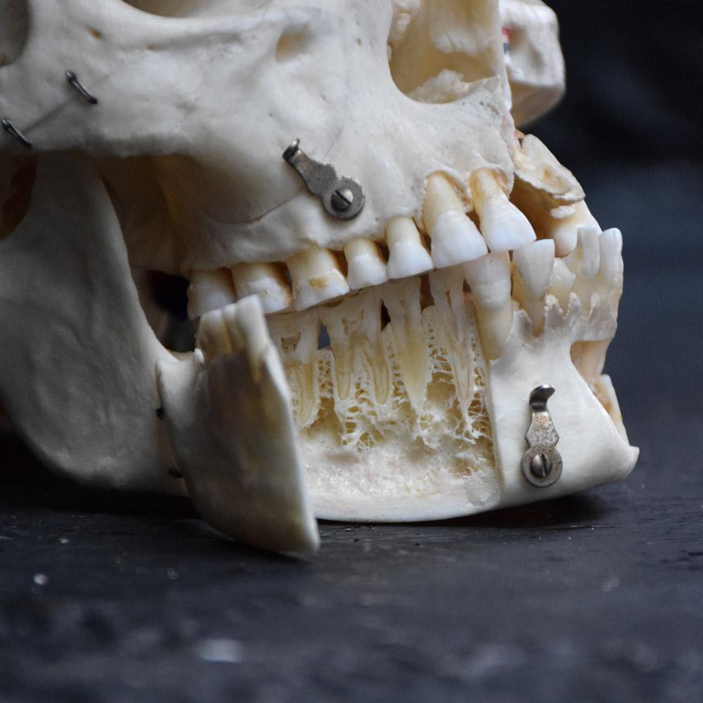 British Demonstration Human Skull