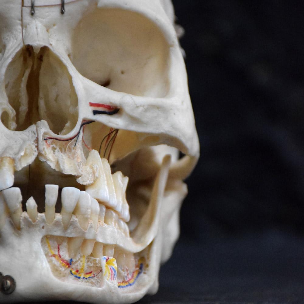 Demonstration Human Skull In Excellent Condition In London, GB