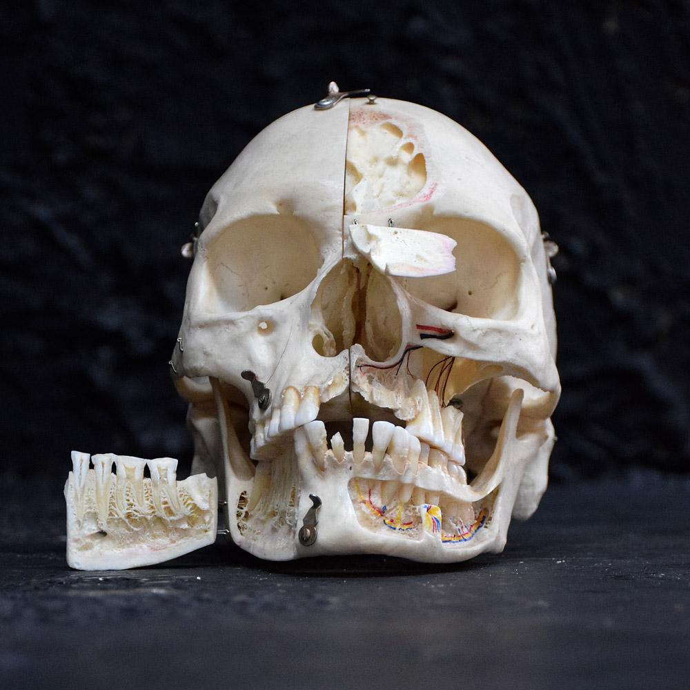 Natural Fiber Demonstration Human Skull