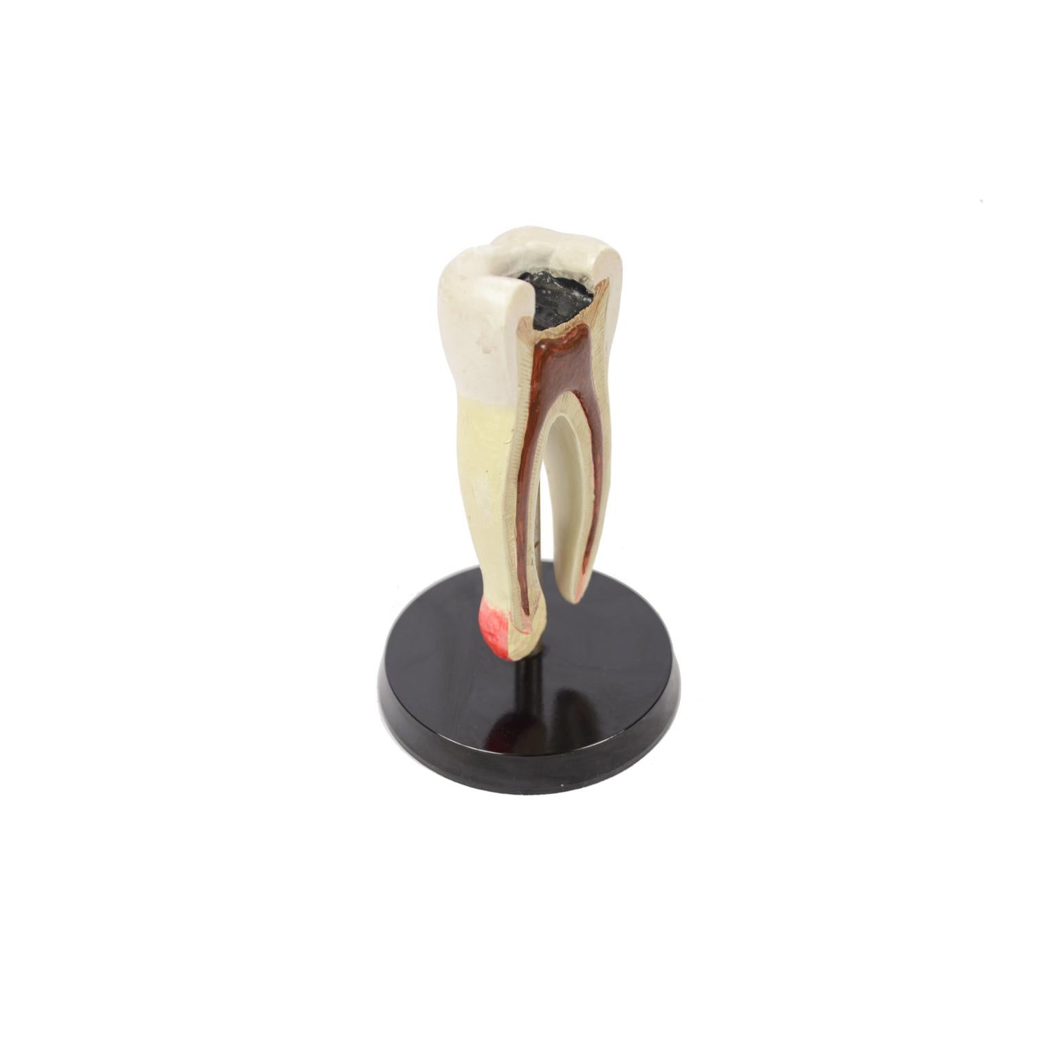 Didactic anatomical enlarged model of a molar tooth in section with double root made of hand-painted rubber resin in ??Germany in the fifties and mounted on a bakelite base. Very good condition. Measures: Height with base cm 14, base diameter cm