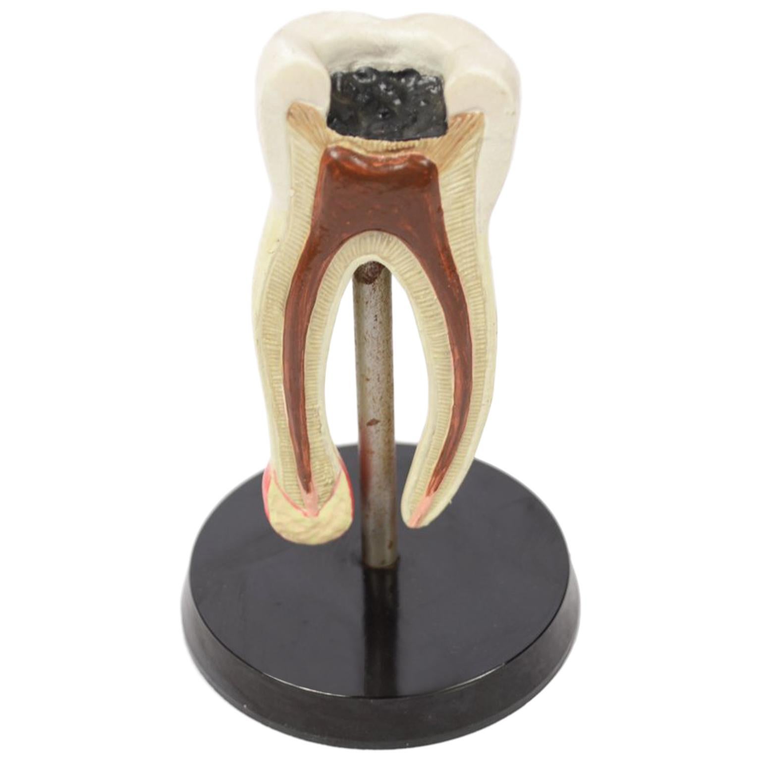 Didactic Anatomical Enlarged Model of a Molar Tooth Made in ​​the 1950s