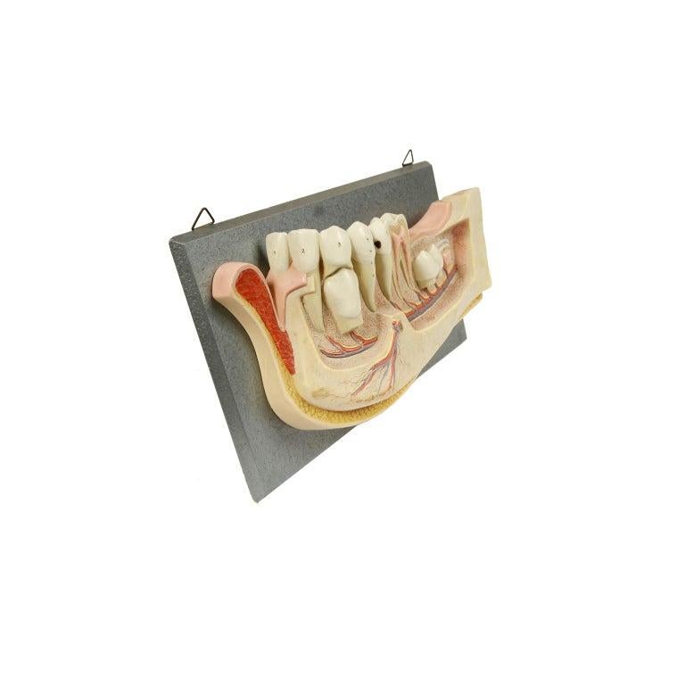 Didactic Resin Anatomical Model of an Enlarged Jaw, Germany, 1950s In Good Condition For Sale In Milan, IT
