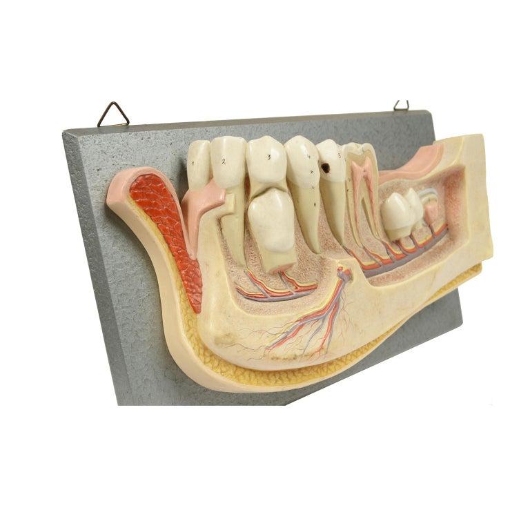 Mid-20th Century Didactic Resin Anatomical Model of an Enlarged Jaw, Germany, 1950s For Sale