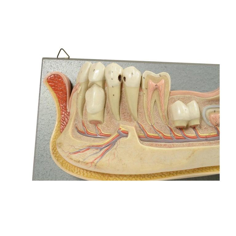 Didactic Resin Anatomical Model of an Enlarged Jaw, Germany, 1950s For Sale 1