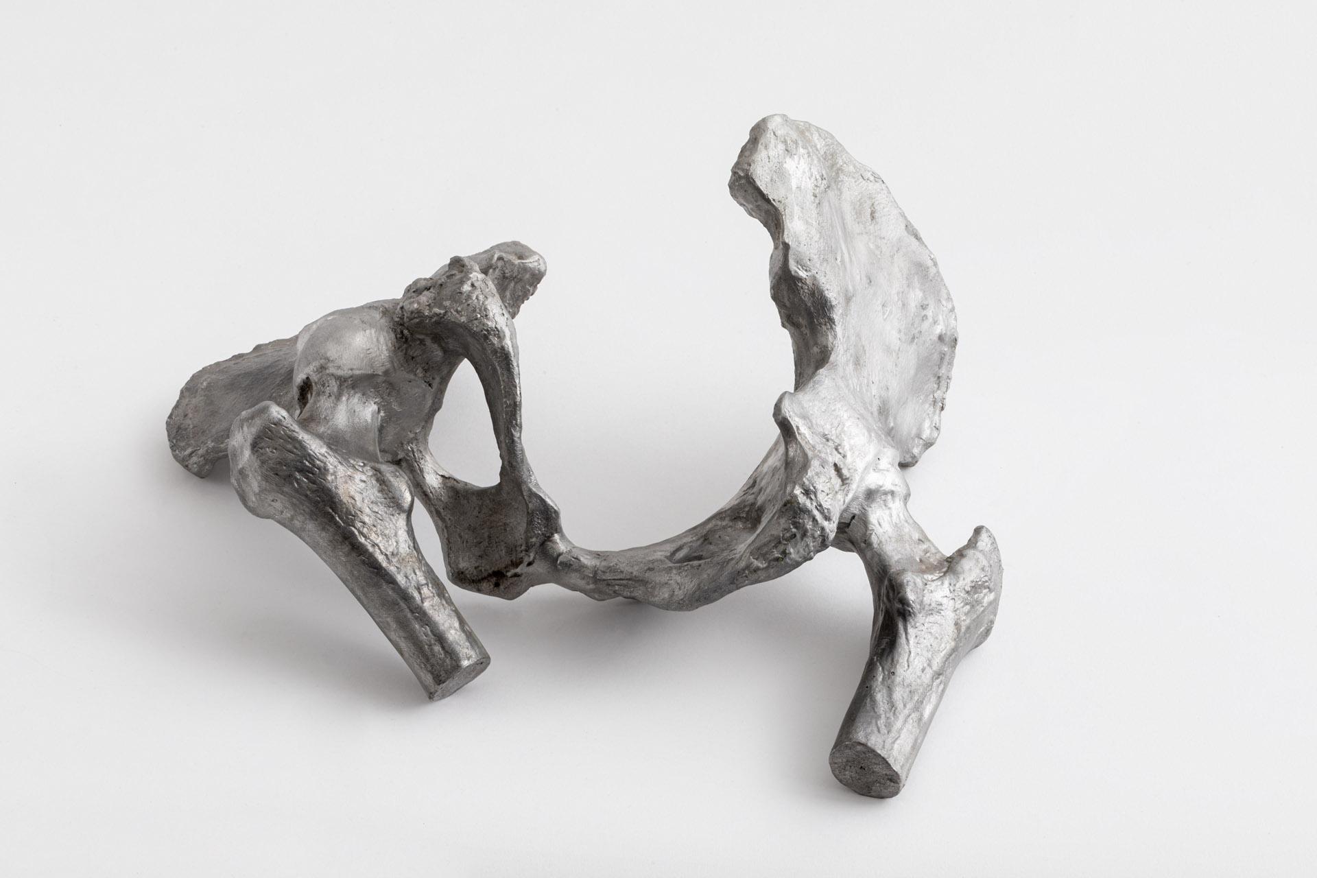 Accident domestique. Description anatomique détaillée d'une hanche de femme cassée et tordue.

*aluminium 100 % recyclé
*Les œuvres d'art en métal moulé de Wanderart sont toutes fabriquées à la main, les dimensions et le poids peuvent donc