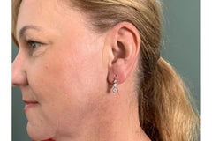 Drop "buttons" earrings with old-cut VS2 diamonds, Austria, early 20th century.