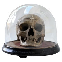 Early 19th century cut medical human skull example in an Antique dome