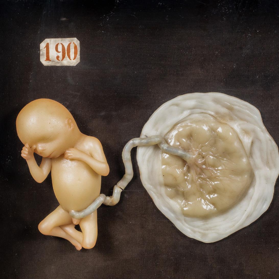 ABOUT

Two early 19th century British wax models of a fetuses with attached placenta. Used as a medical teaching device. Numbered and attached to a velvet background. In a sealed wooden box with early glass front window.

    CREATOR Unknown, United