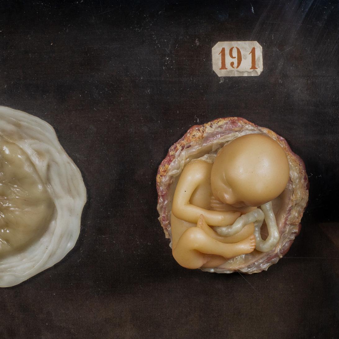 Mid-Century Modern Early 19th c.Medical Teaching Device- Shadowboxed Wax Fetus Models c.1800-1850 For Sale