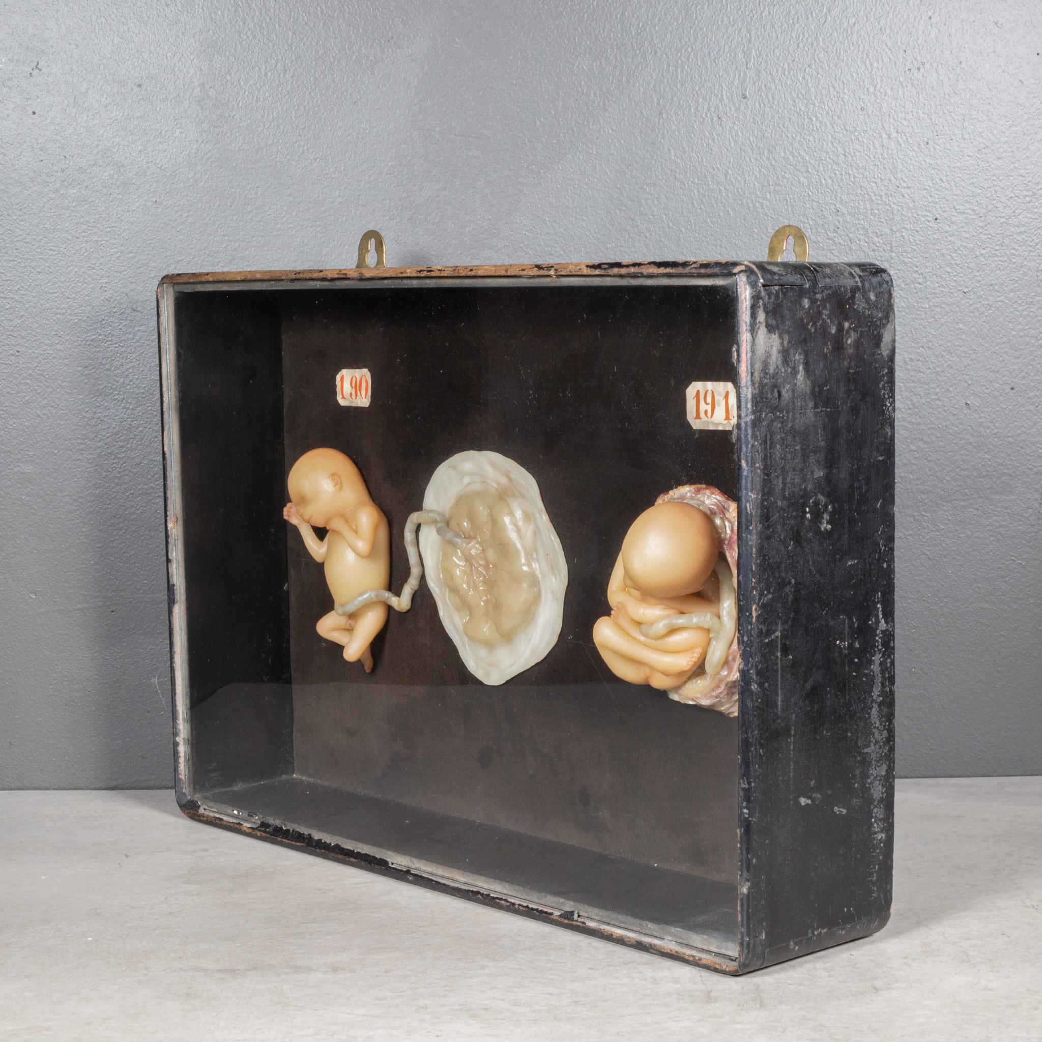Frühes 19. Jahrhundert Medizinische Lehr device – Schaukästen gewachst Wachs Fetus Modelle um 1800-1850 (Holz) im Angebot