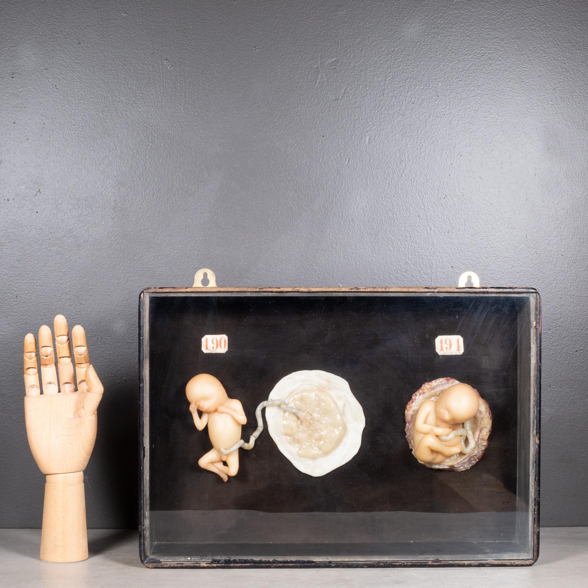 Early 19th c.Medical Teaching Device- Shadowboxed Wax Fetus Models c.1800-1850 For Sale 2