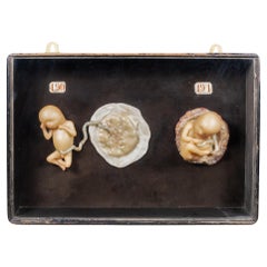 Antique Early 19th c.Medical Teaching Device- Shadowboxed Wax Fetus Models c.1800-1850
