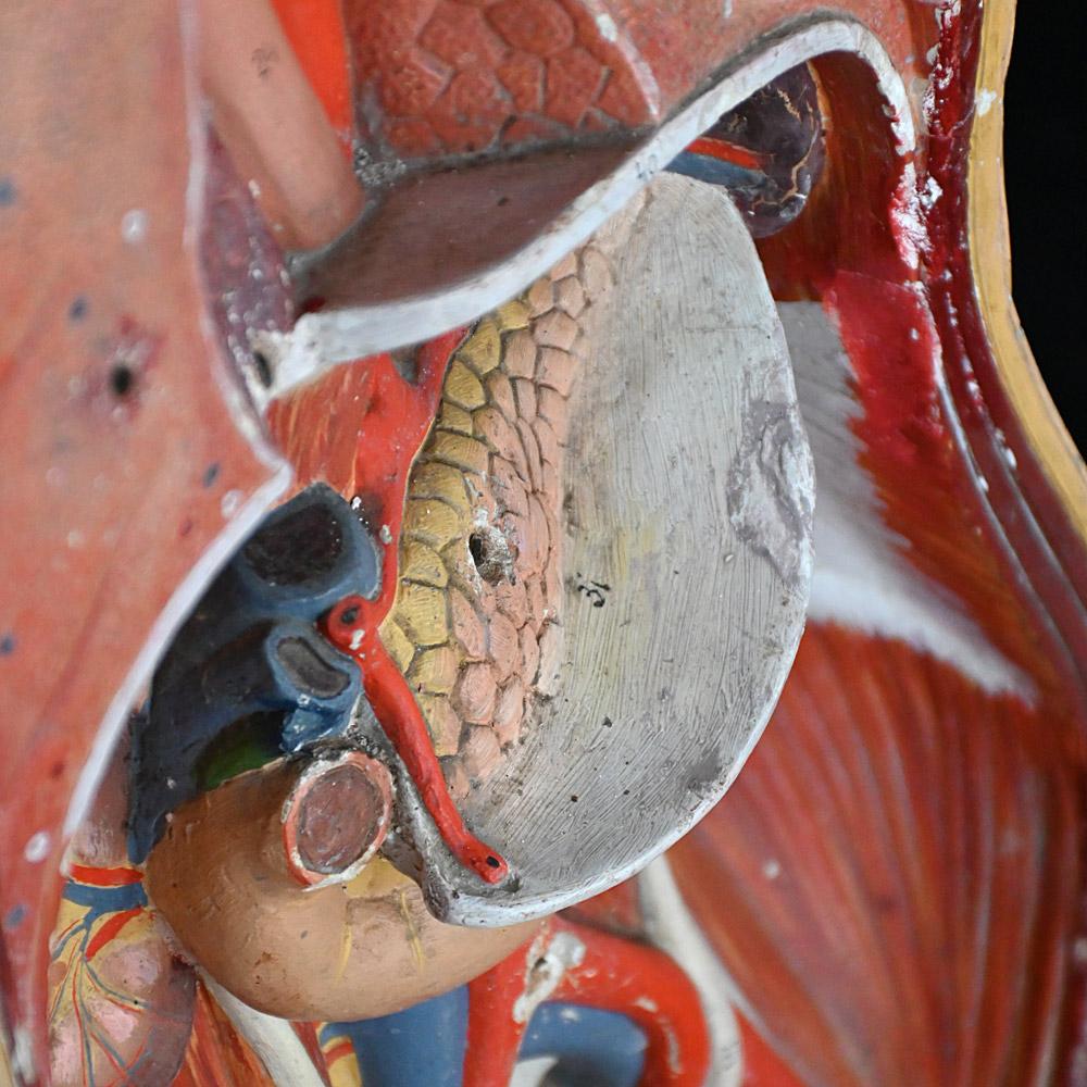 Plâtre Torse médical anatomique en plâtre du début du 20e siècle  en vente