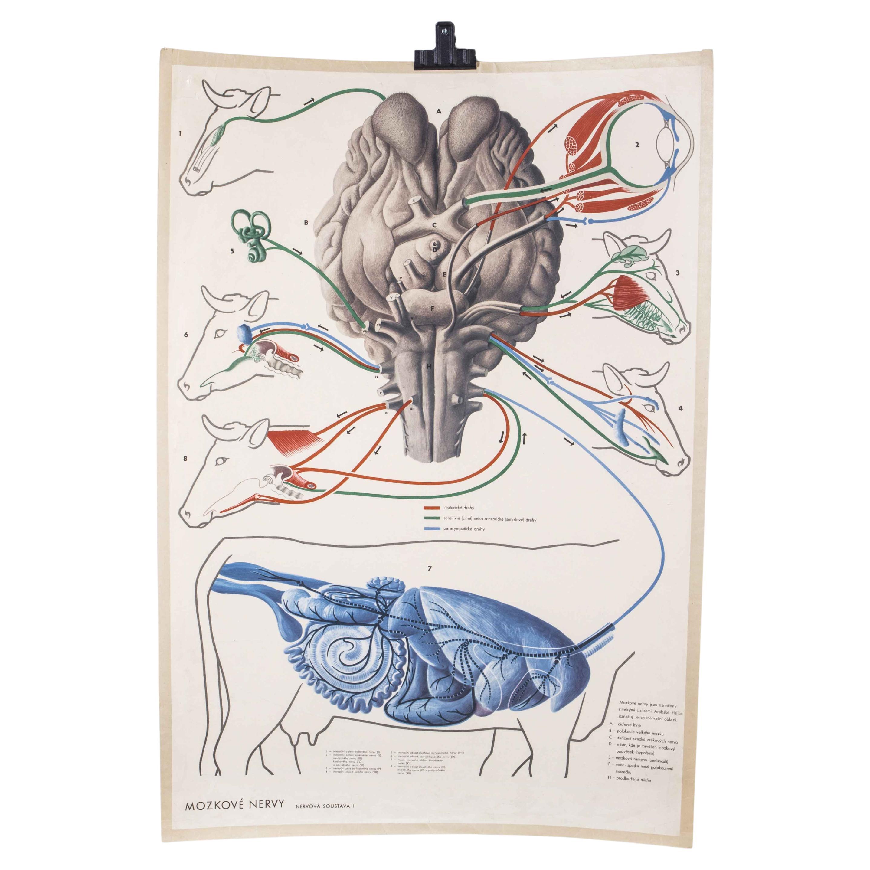 Affiche éducative sur la néphrite et l'anatomie du début du XXe siècle en vente