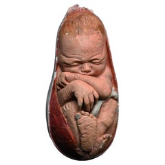 Early 20th Century England Medical School Fetus Model