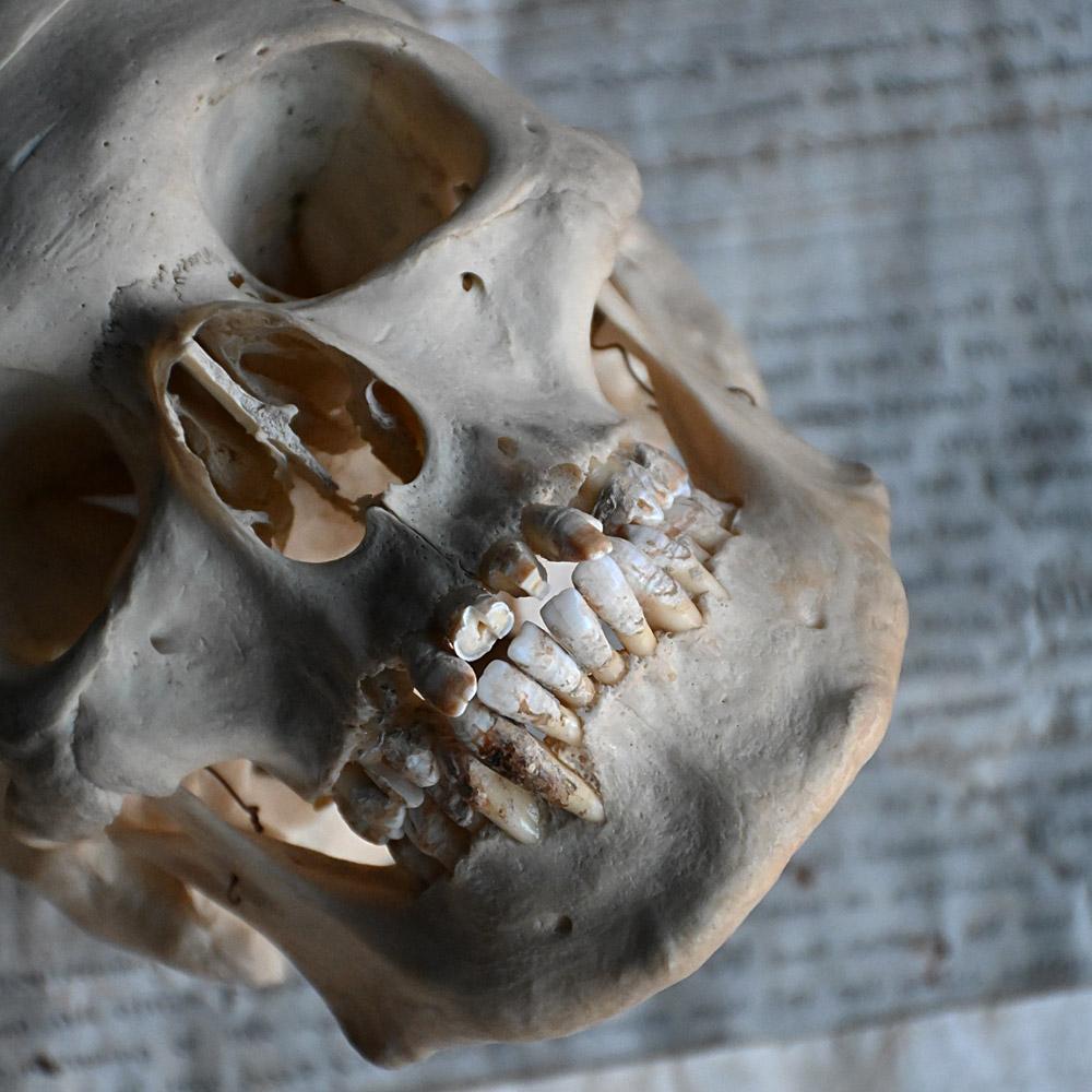 Early 20th Century English Disarticulated Medical Half Human Skeleton 3