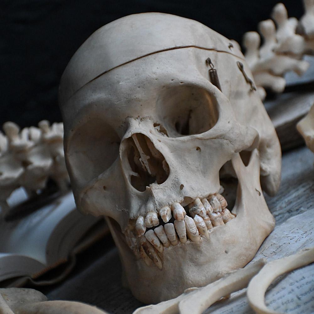 Early 20th Century English Disarticulated Medical Half Human Skeleton  

An early 20th Century English disarticulated medical half human skeleton. Its comes in its original old cardboard box. For sale are all the pieces photographed. This is a real