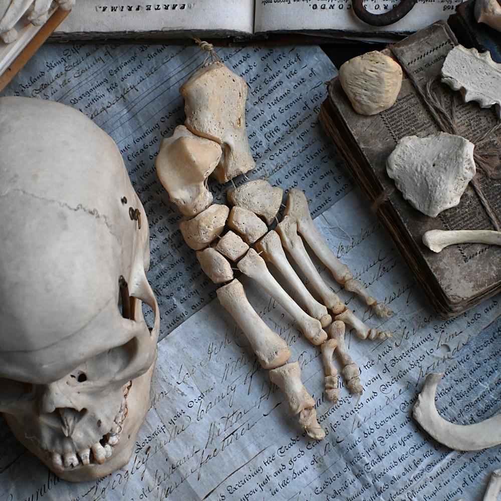 Victorian Early 20th Century English Disarticulated Medical Half Human Skeleton