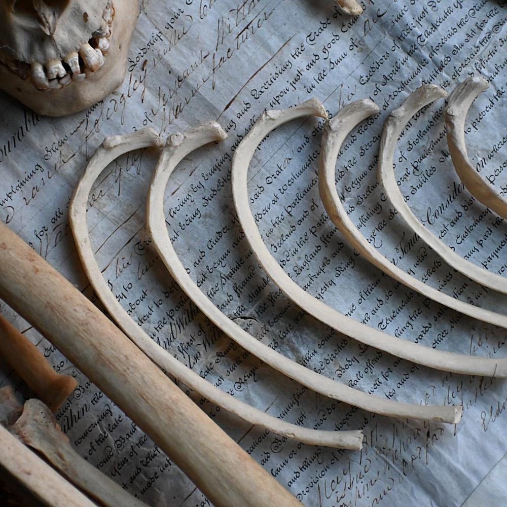 Hand-Crafted Early 20th Century English Disarticulated Medical Half Human Skeleton