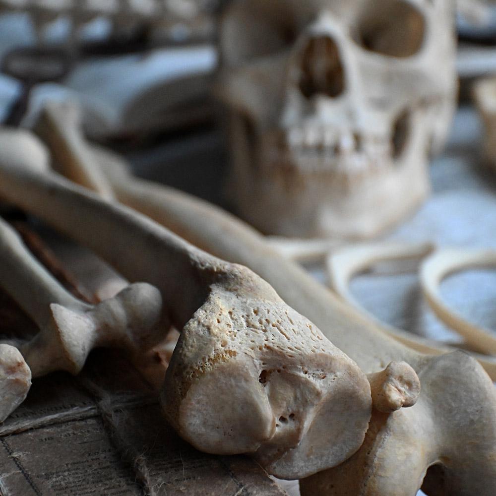 Early 20th Century English Disarticulated Medical Half Human Skeleton In Good Condition In London, GB