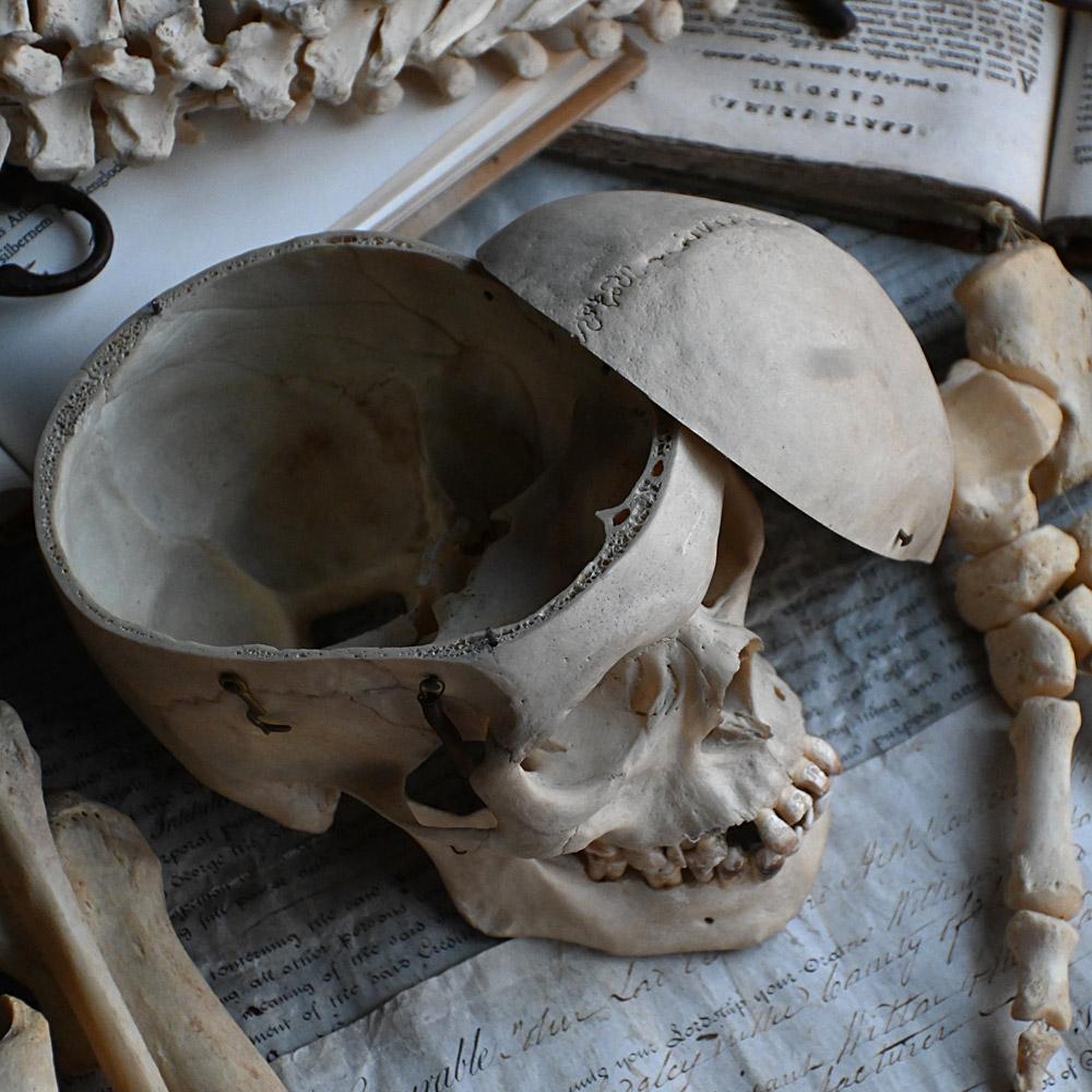 Early 20th Century English Disarticulated Medical Half Human Skeleton 2