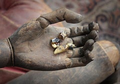 Early 20th Century Medical Curios Gold Teeth Dentures