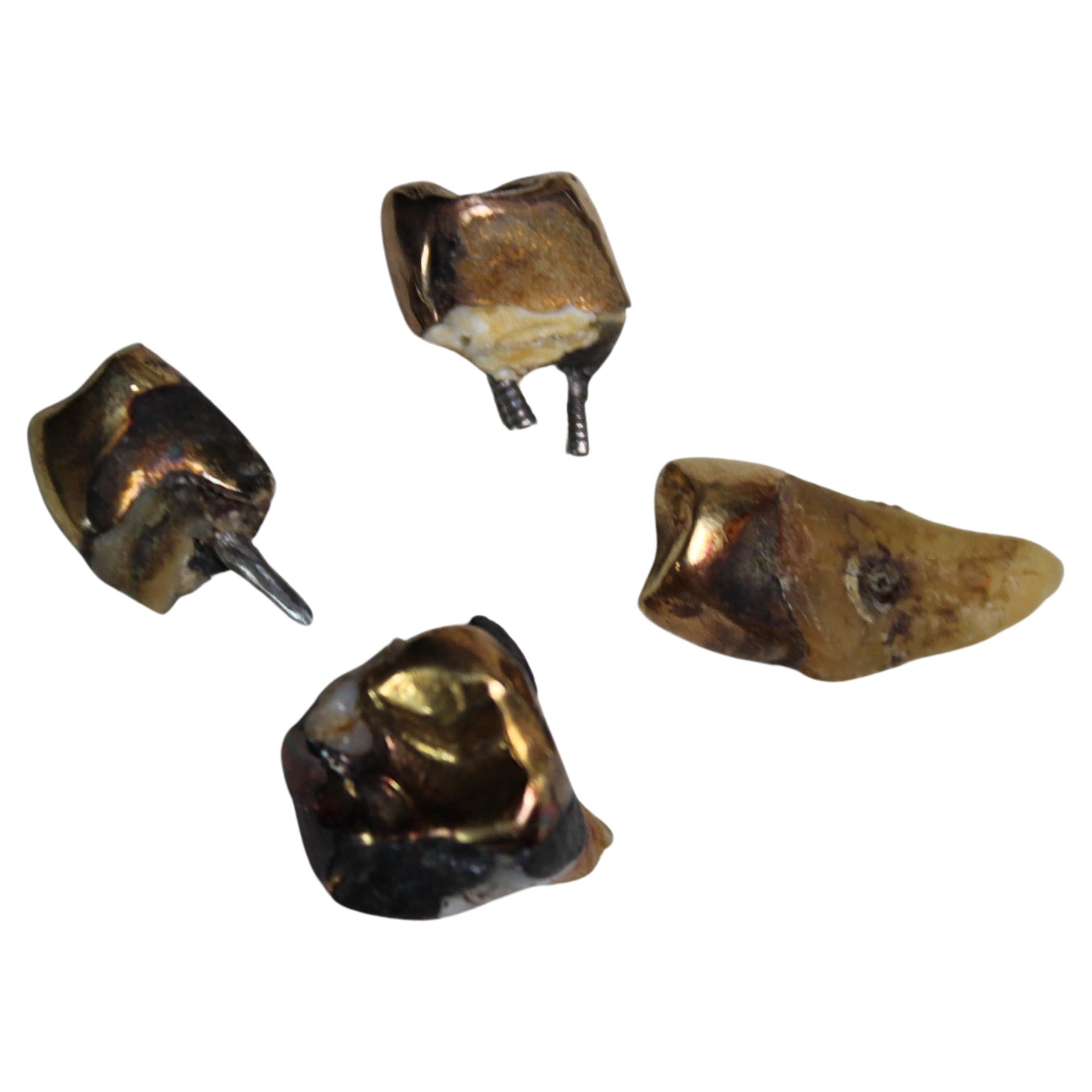 Early 20th Century Medical Curios Gold Teeth Dentures For Sale