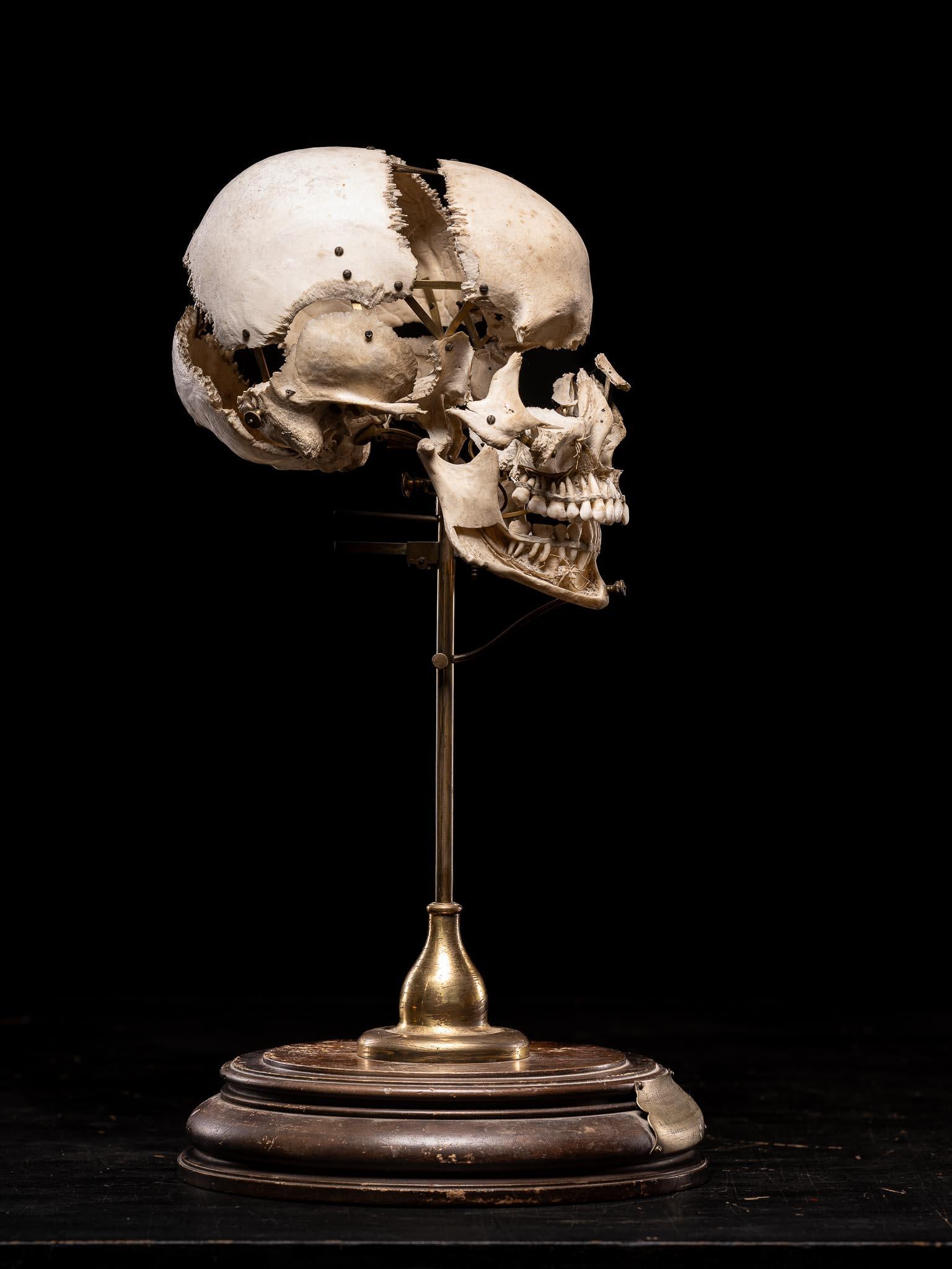 Français Crâne humain désarticulé d'Edmé Beauchêne avec provenance muséale, France en vente