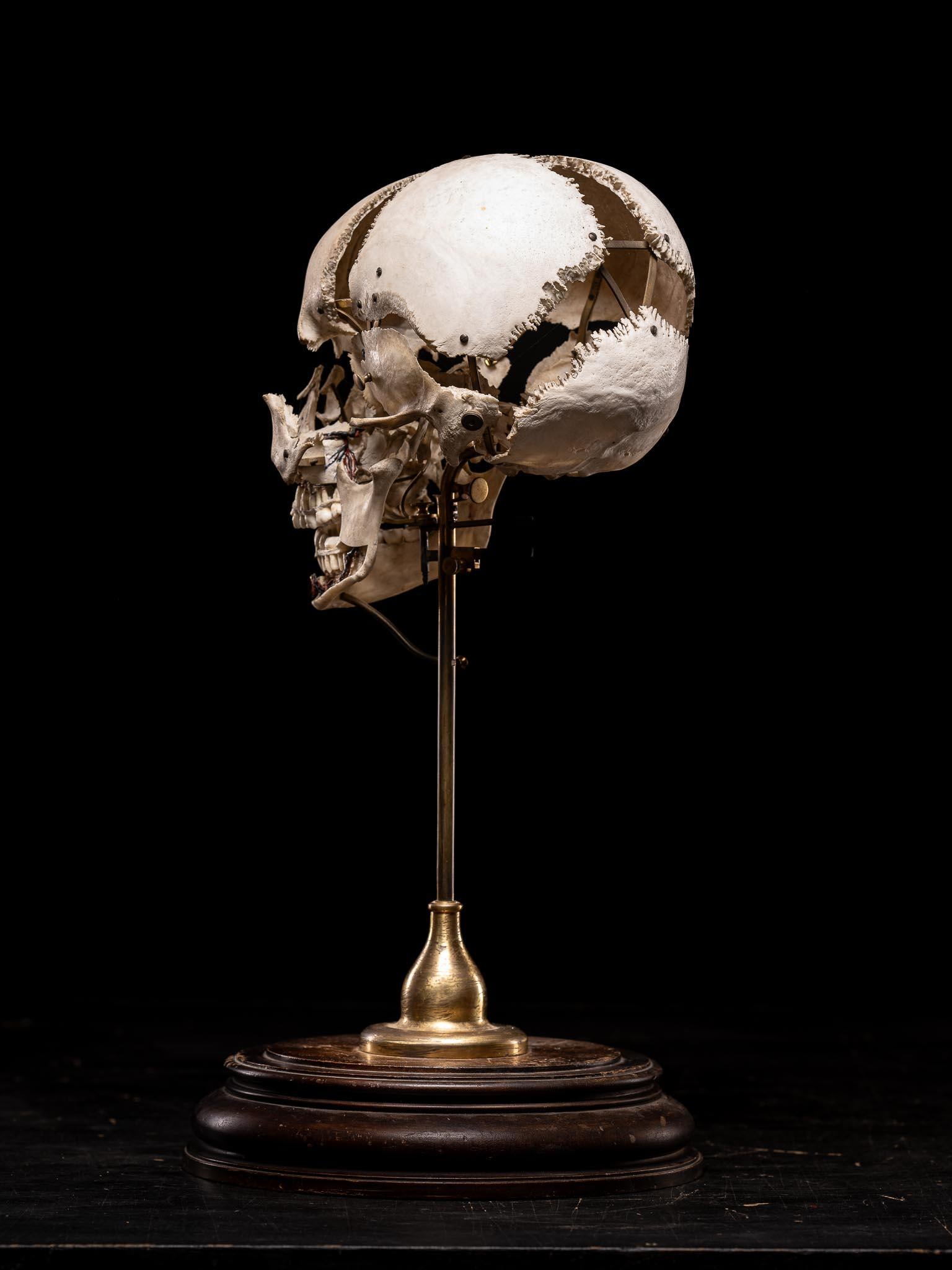 Exartikulierter menschlicher Schädel von Edmé Beauchêne mit musealer Provenienz, Frankreich (19. Jahrhundert) im Angebot