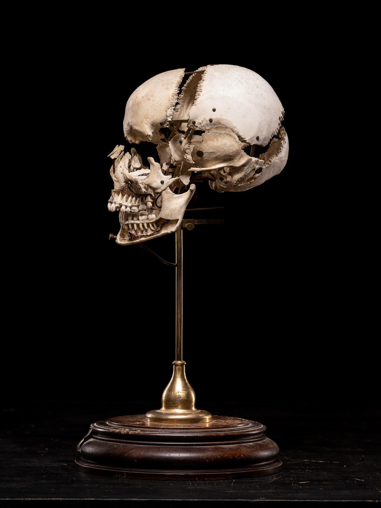 Matériaux organiques Crâne humain désarticulé d'Edmé Beauchêne avec provenance muséale, France en vente