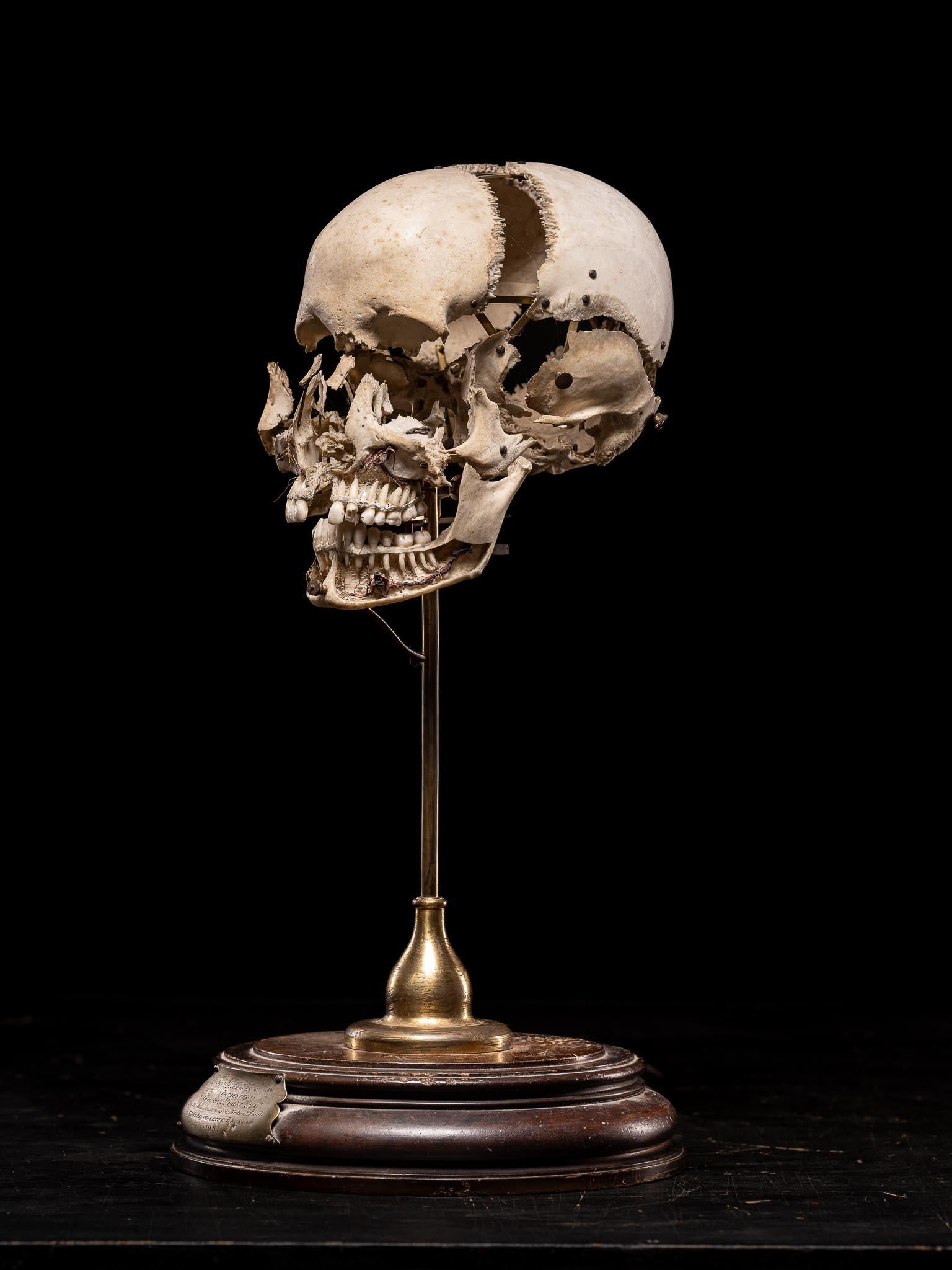 Exartikulierter menschlicher Schädel von Edmé Beauchêne mit musealer Provenienz, Frankreich im Angebot 1