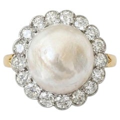 Edwardian 12 MM. Mabe Split Pearl 1.60 Ct Diamond Engagement Ring