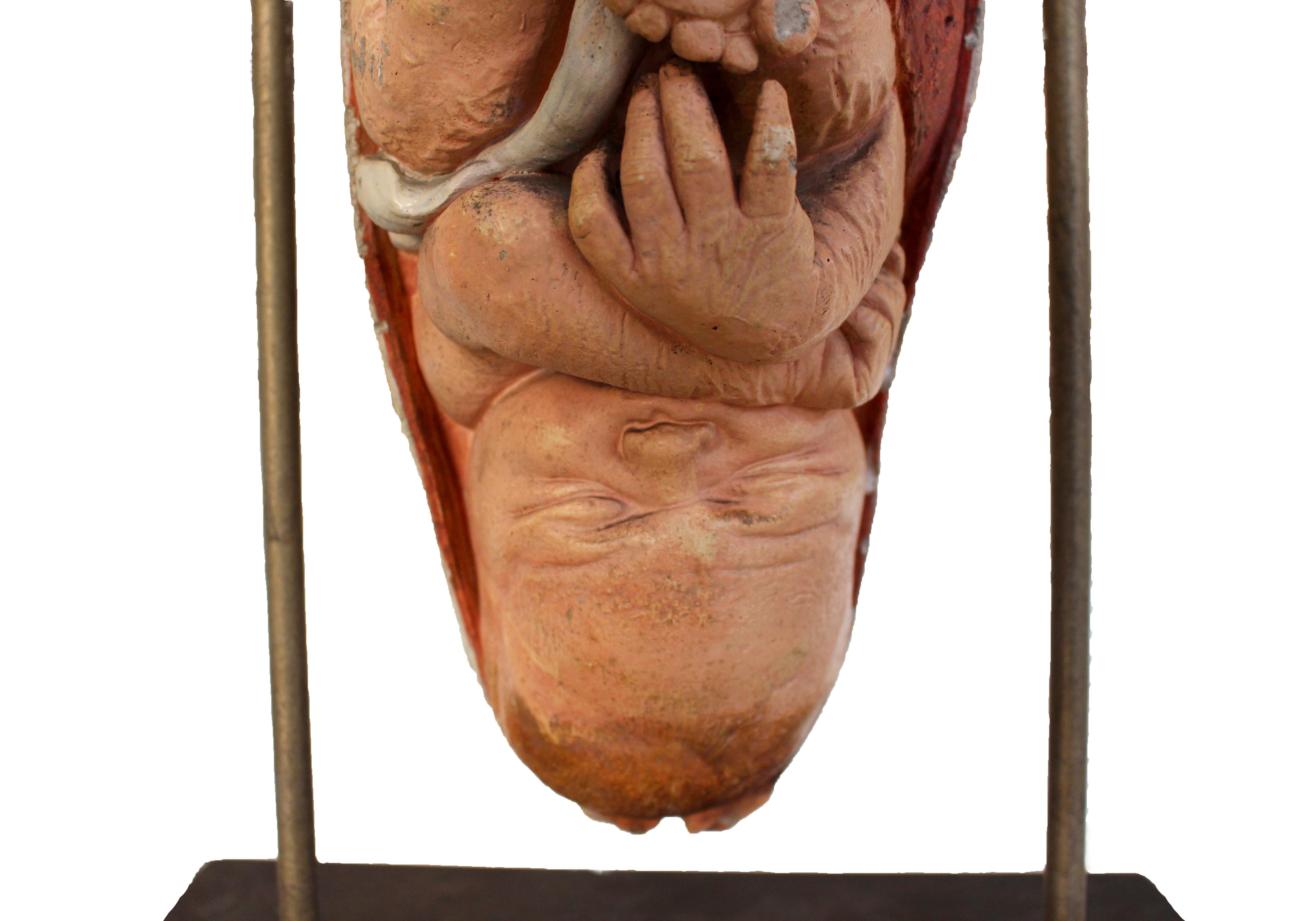 An unsual 20th century curiosity of a scientific example of a baby in the womb hung on a curved metal frame into a wooden base.