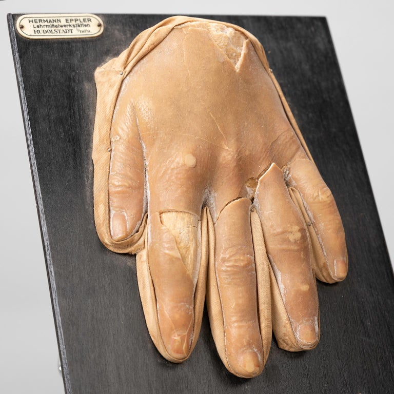 Five Anatomical Wax Models by Hermann Eppler For Sale at 1stDibs