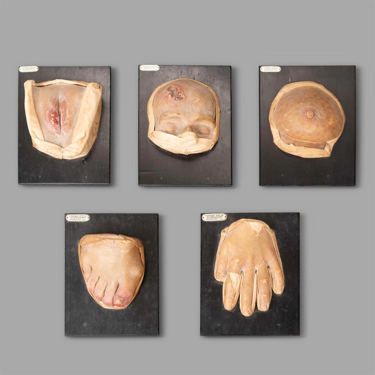 Five Anatomical Wax Models by Hermann Eppler For Sale at 1stDibs