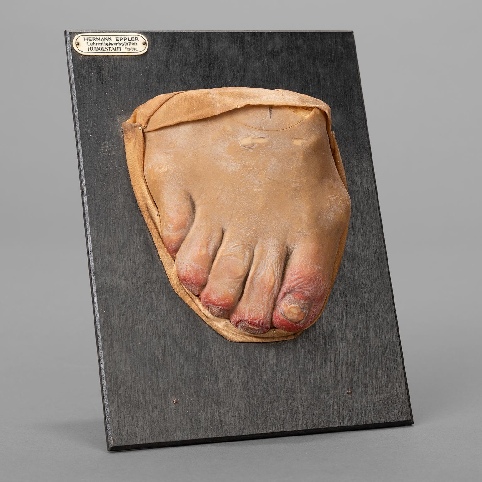 Five Anatomical Wax Models by Hermann Eppler For Sale at 1stDibs
