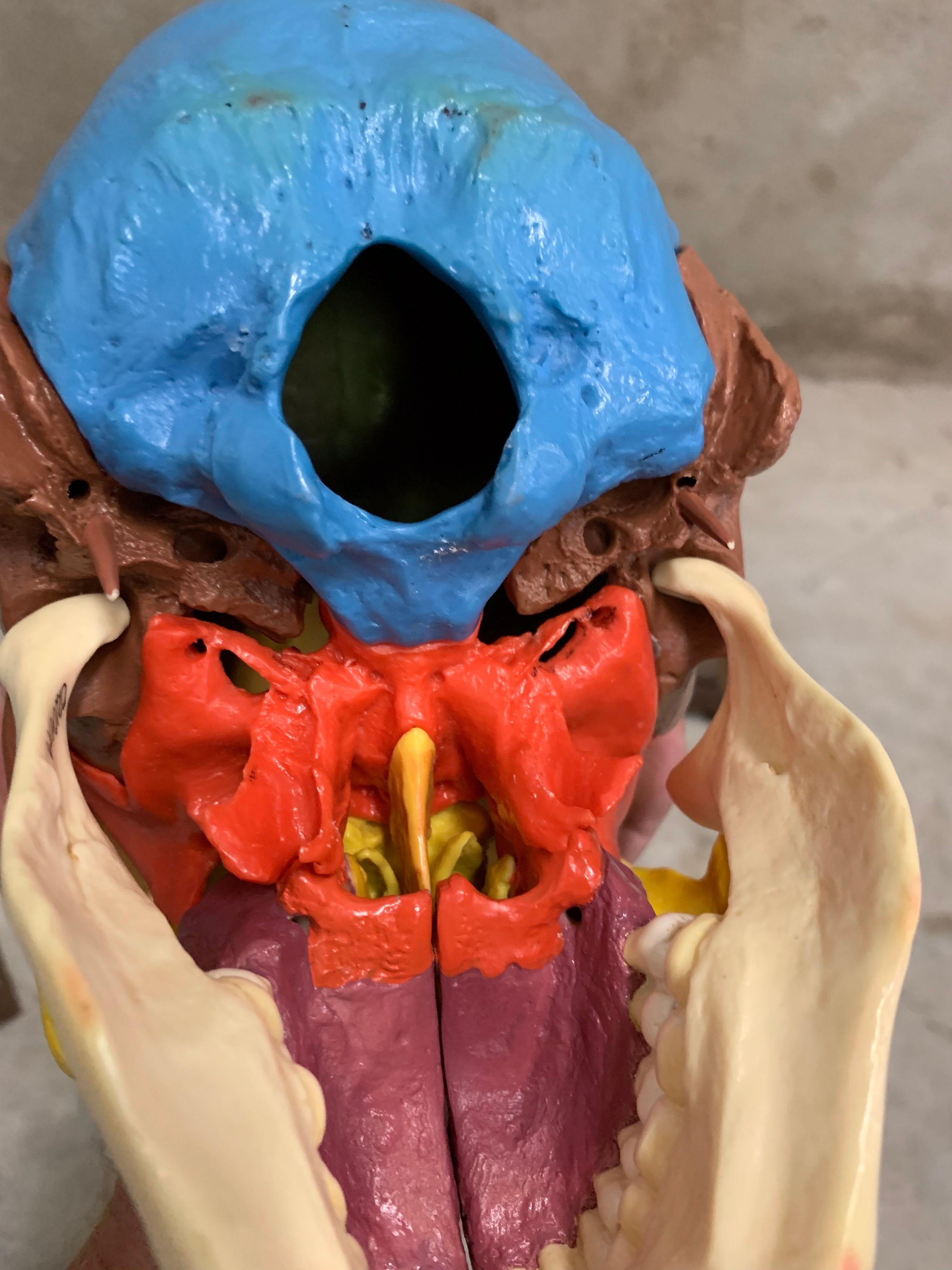 Metal Full-Size Somso Skull Learning Model in Display Case, 1990's