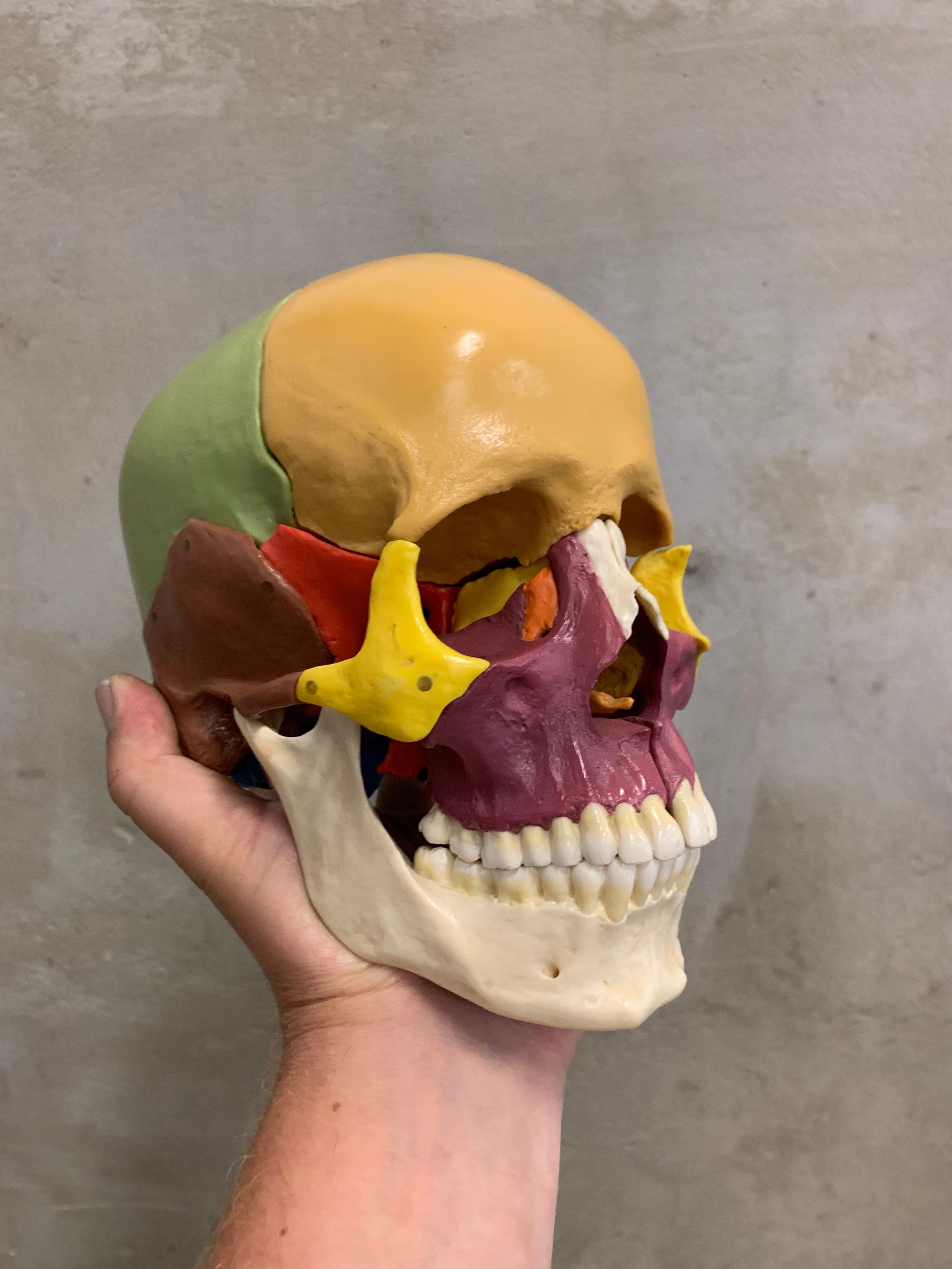 Full-Size Somso Skull Learning Model in Display Case, 1990's 1