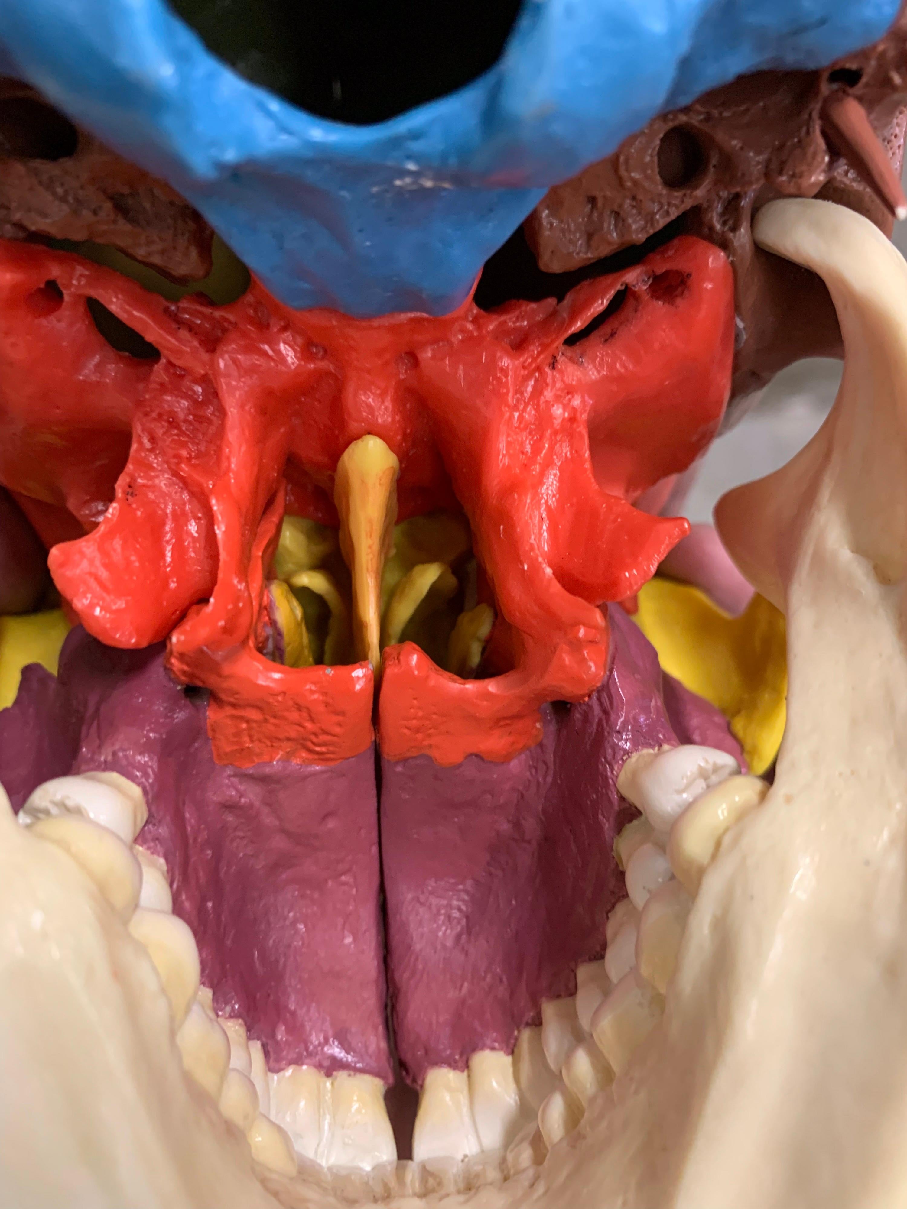 Full-Size Somso Skull Learning Model in Display Case, 1990's 3