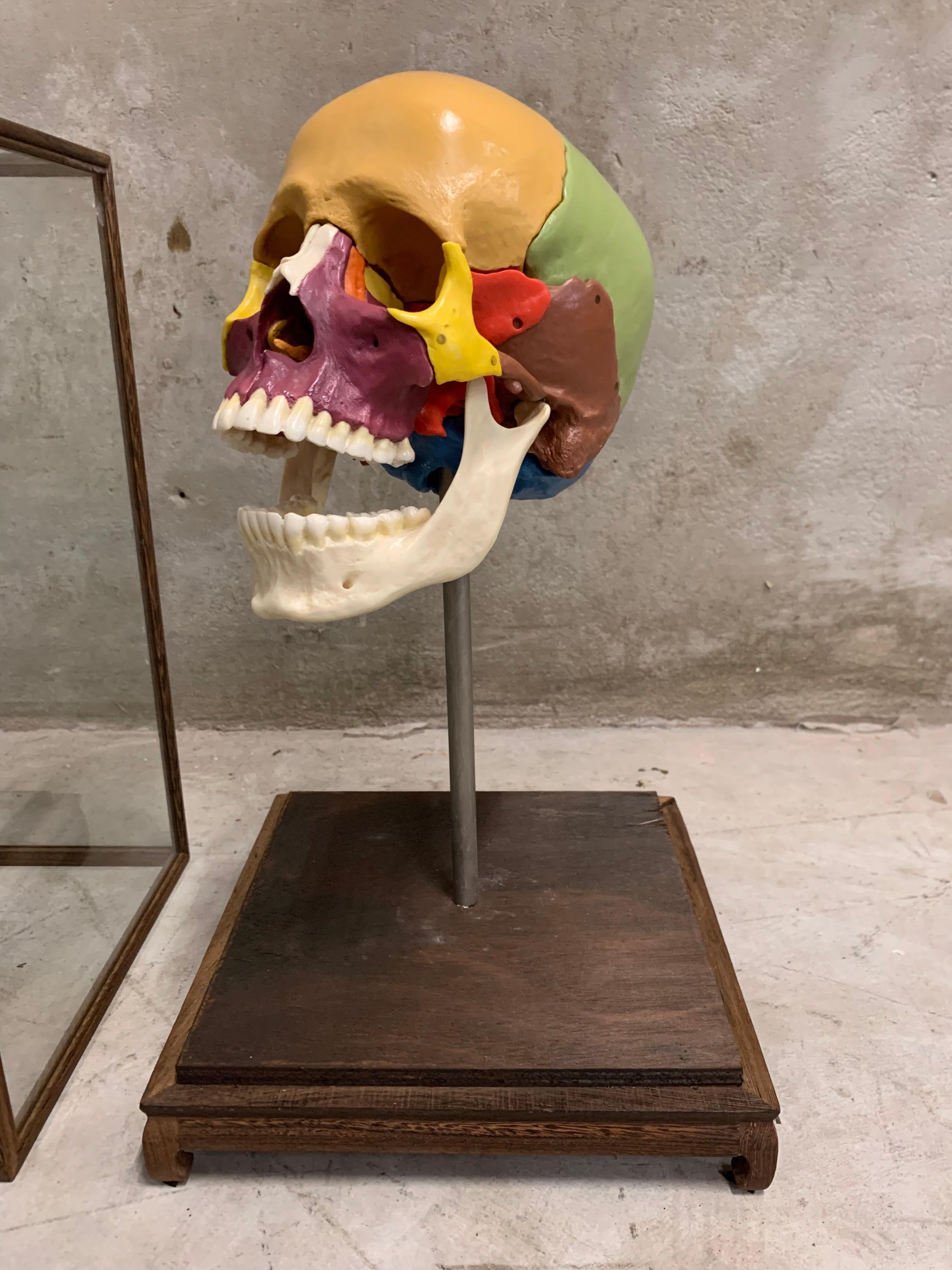 Full-Size Somso Skull Learning Model in Display Case, 1990's 4