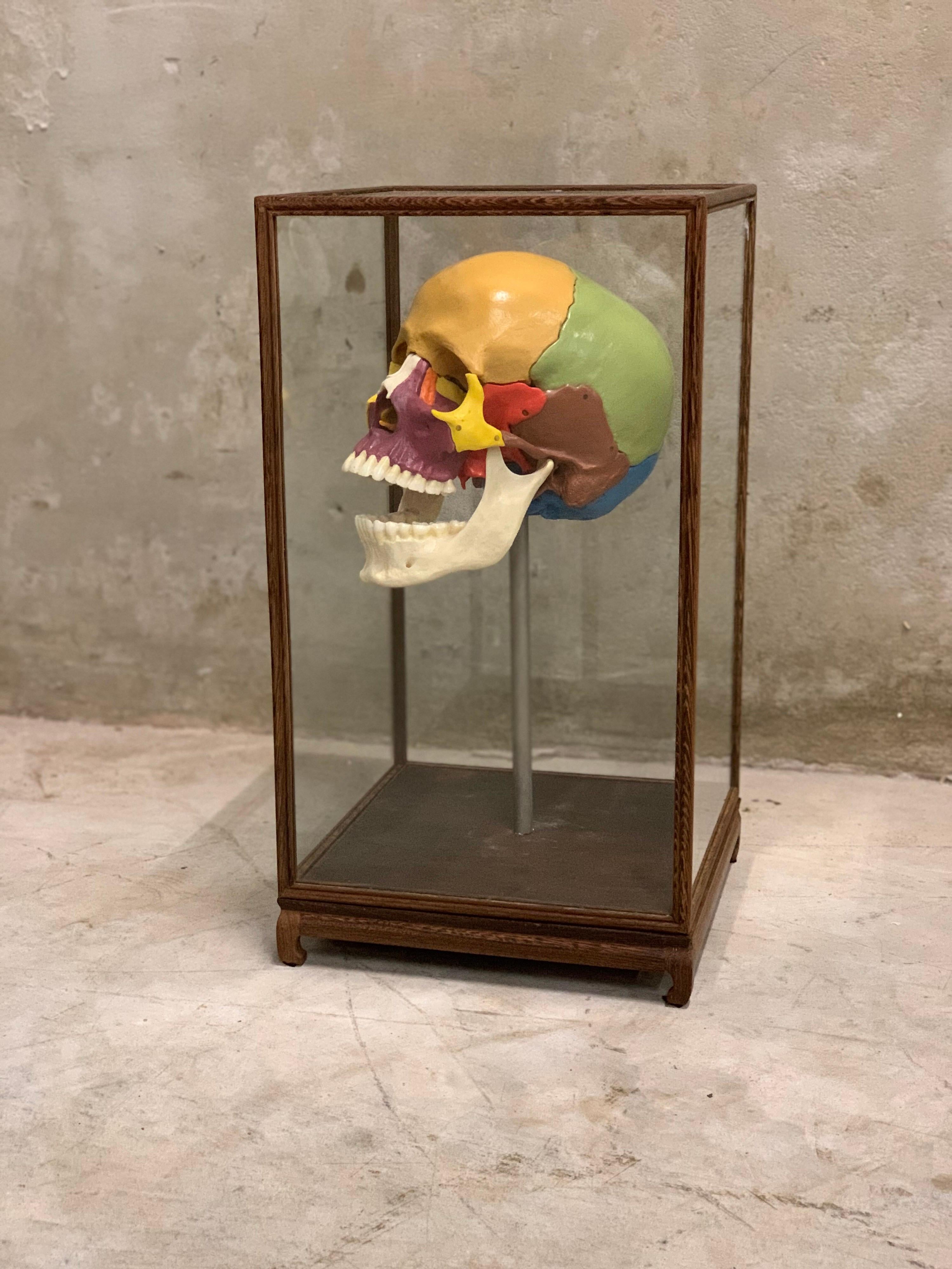 bone display case