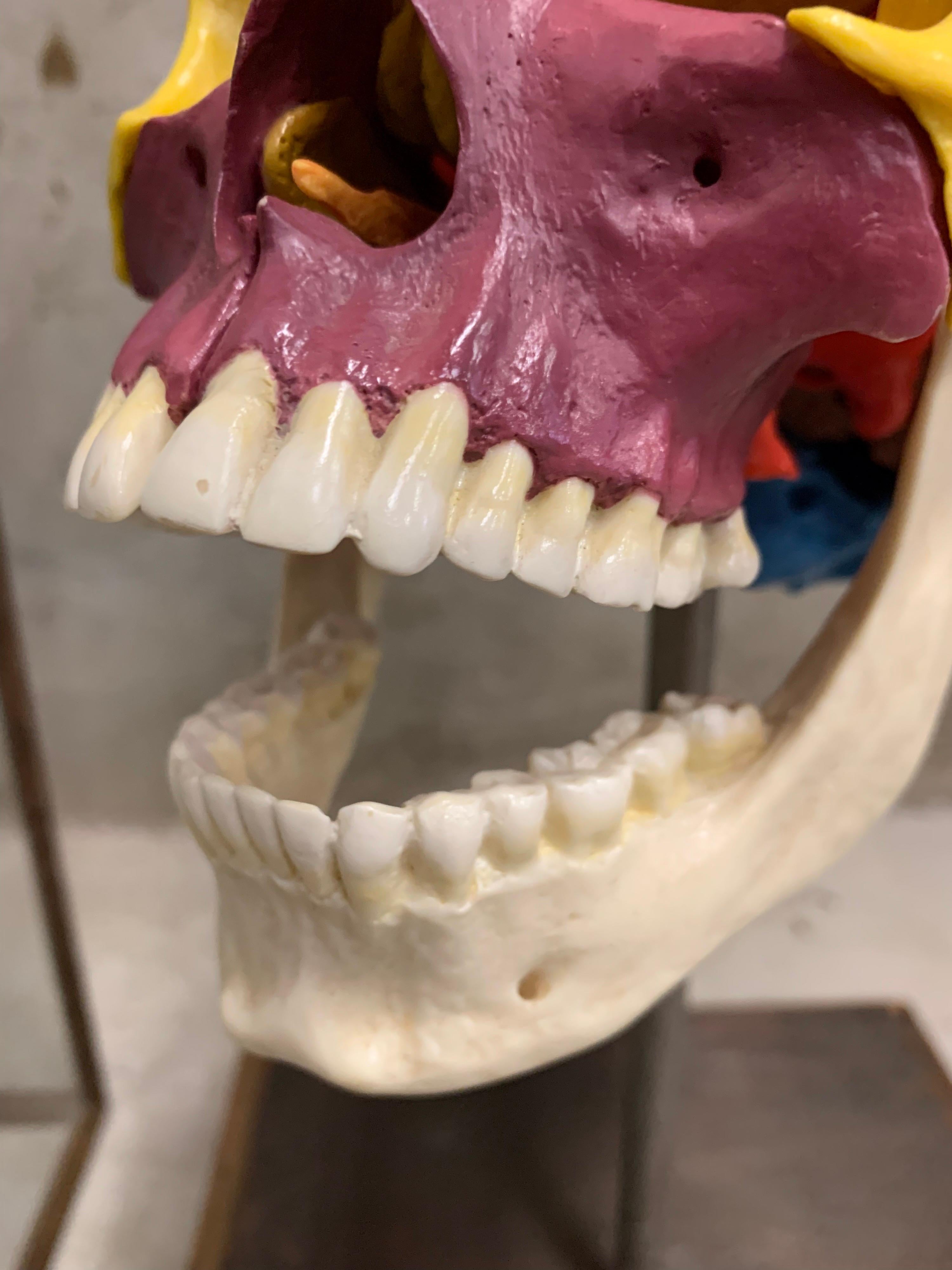German Full-Size Somso Skull Learning Model in Display Case, 1990's
