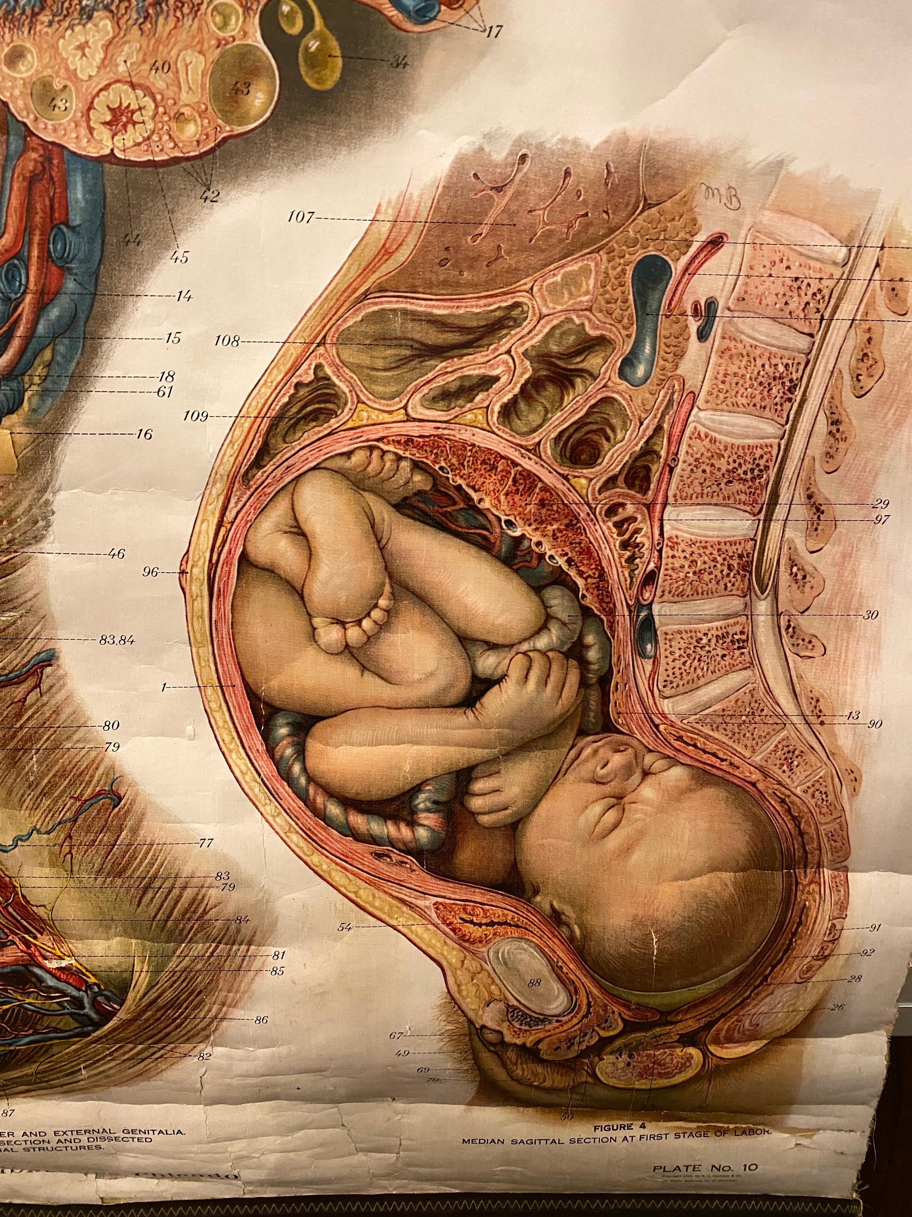 Tableau anatomique Genito-Urinary de Fritz Frohse  en vente 2