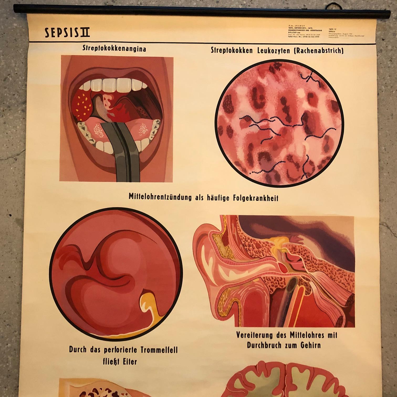 anatomy of sepsis