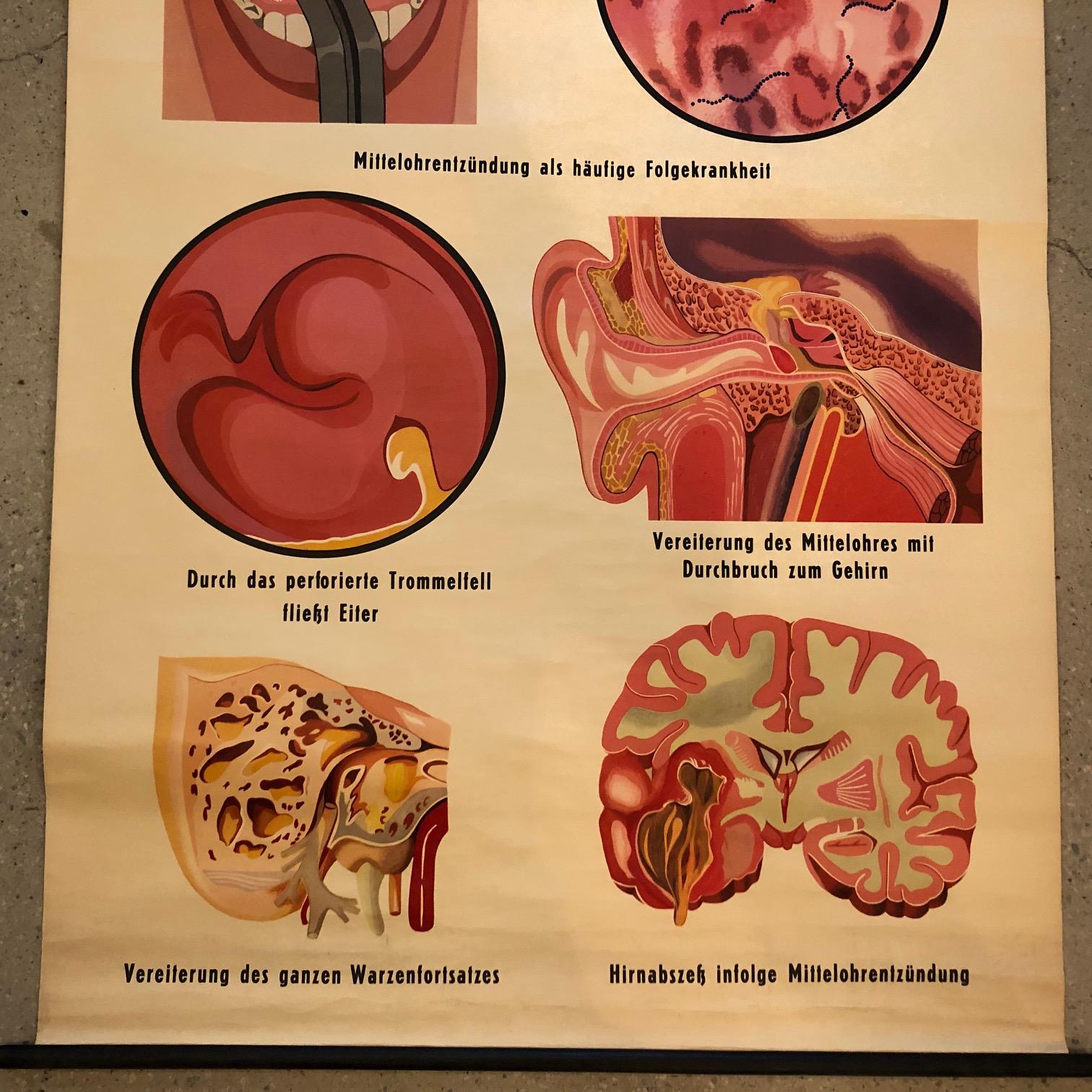 Deutsche Anatomische Sepsis-Schulungstafel im Zustand „Gut“ im Angebot in Brooklyn, NY